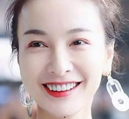 明星牙齿烤瓷牙,牙齿烤瓷牙的神奇魅力